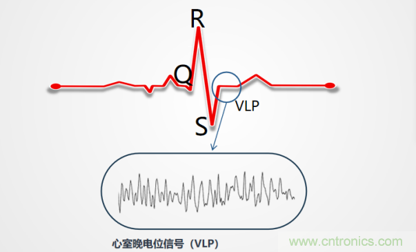 解決心電監測行業難題,曼森伯格的濾波技術獲國家知識產權局發明授權 解決心電監測行業難題,曼森伯格的濾波技術獲國家知識產權局發明授權