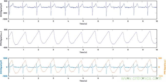 可穿戴市場喜迎生物醫學“多面手”