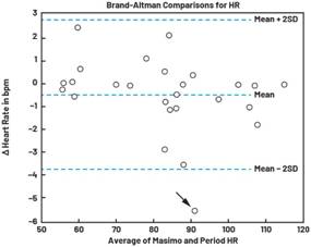 動態離散周期變換技術突破：無ECG參考的生理信號精準解析