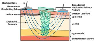  圖5.人體皮膚分層橫截面以及TMD和生物阻抗測量  考慮到生物阻抗分析的無創性，使用兩個金屬電極代表電氣傳感器，連接模擬前端(AFE)電路和患者皮膚。這個金屬與非金屬的接觸點是構成整個電路的另一個關鍵部分，連接了AFE和人體電氣模型。電荷載體（電極中的電子和人體內的離子）之間的相互作用可能對這些傳感器的性能產生重大影響，需要根據每種應用進行具體考慮。首先，金屬與離子溶液接觸的相互作用導致金屬表面附近溶液中離子濃度的局部變化。這種現象會改變電極下方區域的電荷中性，導致金屬周圍的電解質電位與溶液其余部分不同，從而在金屬和電解質主體之間產生一個電位差，即常說的“半電池電位”。其次，注入電流的直流分量會導致電極極化。  表1.各種電極類型和相應的半電池電位  金屬及反應  半電池電位(V)  Al → Al3+ + 3e- Al → Al3+ + 3e-  –1.706 –1.706  Ni → Ni2+ + 2e- Ni → Ni2+ + 2e-  –0.230 -0.230  H2 → 2H+ + 2e- H2 → 2H+ + 2e-  0.000 (by definition) 0.000（根據定義）  Ag + Cl- → AgCl + e- Ag + Cl- → AgCl + e-  +0.223 +0.223  Ag → Ag+ + e- Ag → Ag+ + e-  +0.799 +0.799  Au → Au+ + e- Au → Au+ + e-  +1.680 +1.680  這是一種不良現象，往往導致電極性能下降。這些考量表明，電極也需要定義適當的電氣模型（參見圖6）。我們可以將干電極表示為具有三個串聯元件的電路：一個用于模擬半電池電位(EHC)的直流電源；一個用于模擬金屬和非金屬（人體）之間接觸的RC并聯電池(Rd||Cd)；以及一個用于模擬電極金屬的電阻Rs。